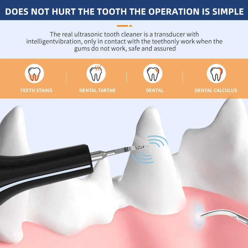 Pawty Global Wholesale Smart Ultrasonic Pet Dental Scaler with Negative Ion Technology - Image 6